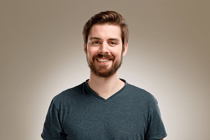 beard and moustache transplant